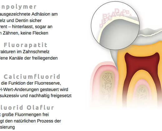 H-nano Seal – Bild 2