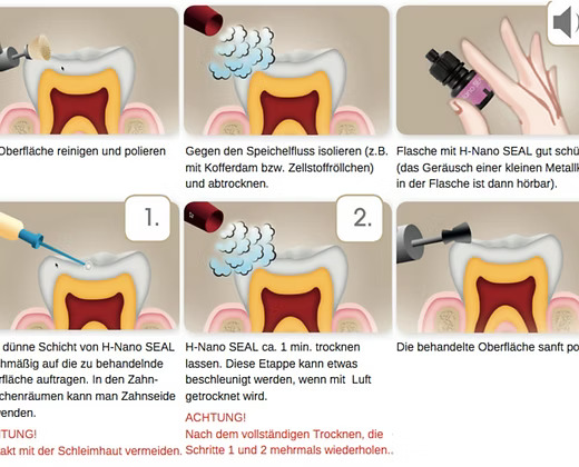 H-nano Seal – Bild 3