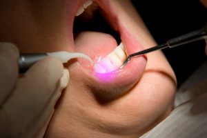 Medizinische Lasertechnologie
