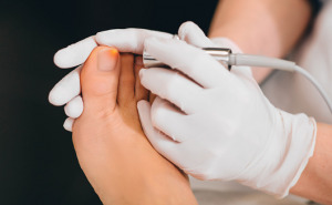 laser treatment on toenail, fungal infection on the toenails Medizinische Lasertechnologie