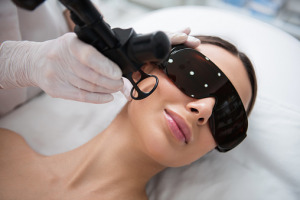 Lady on laser fractional rejuvenation of face Medizinische Lasertechnologie